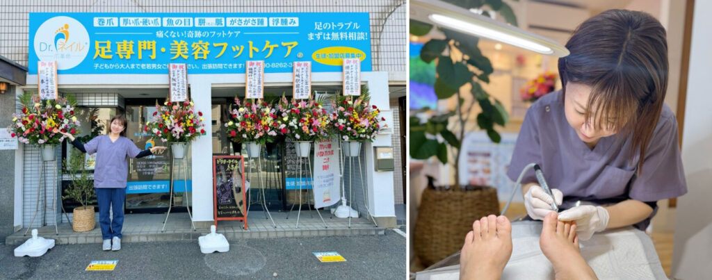 ドクターネイル爪革命九州本店のリニューアルオープン画像・施術中の写真